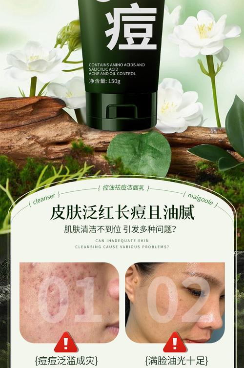 洗面奶青春期控油淡化痘印青少年学生男女士洁面乳